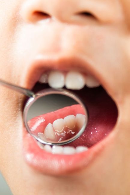 Odontoiatria pediatrica